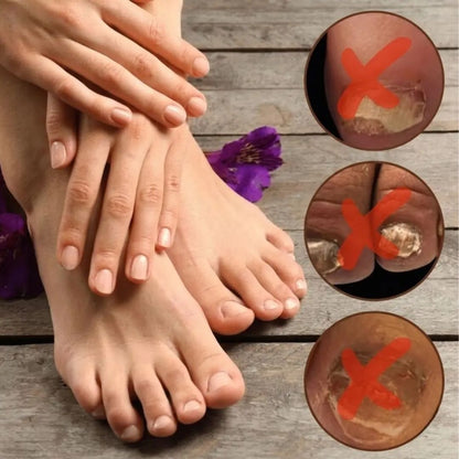 NailPure™ | Nail Fungus Solution