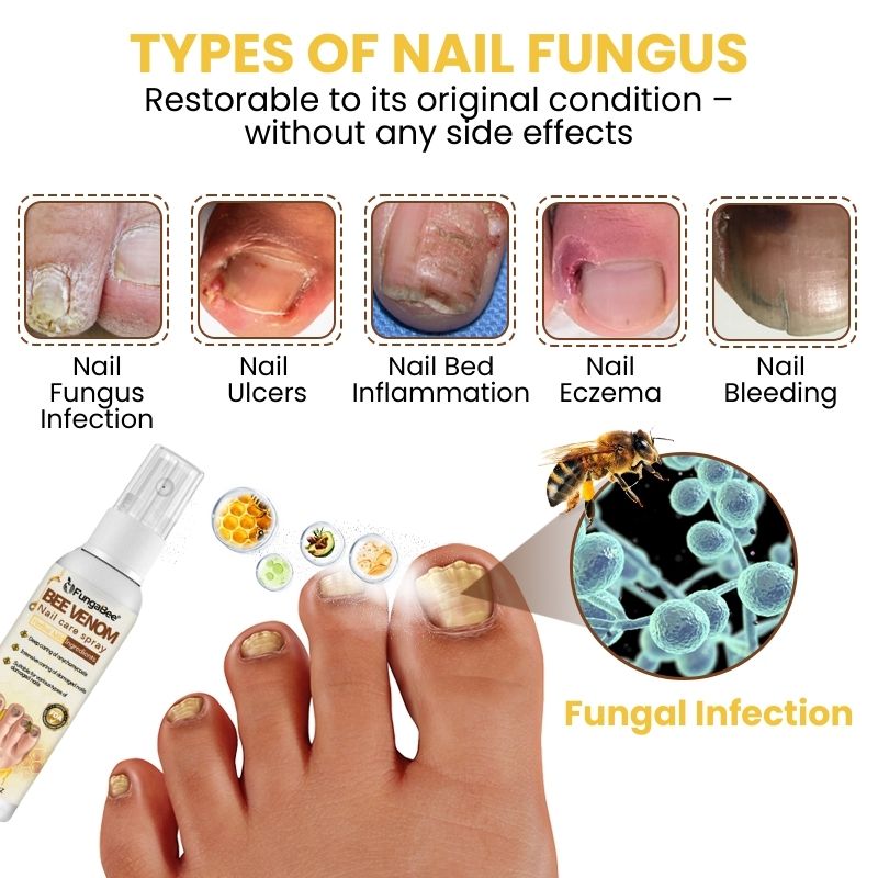 FungaBee® | Bee Venom Nail Care Spray