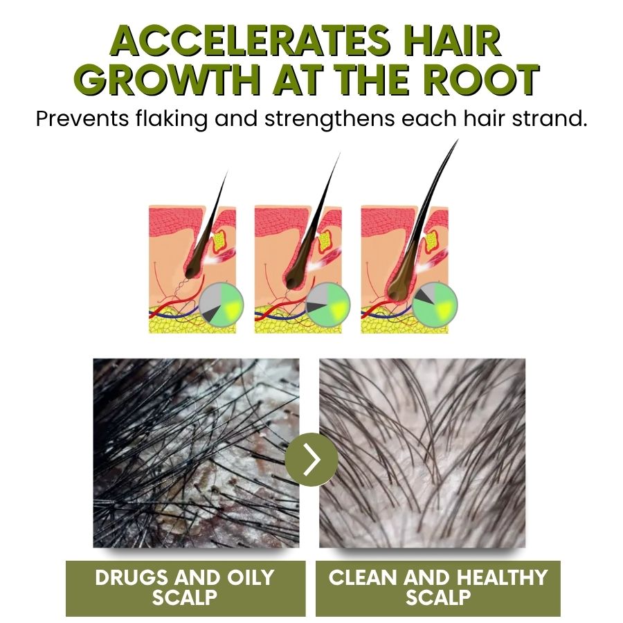 FloraHair™ | Veganic Hair Oil