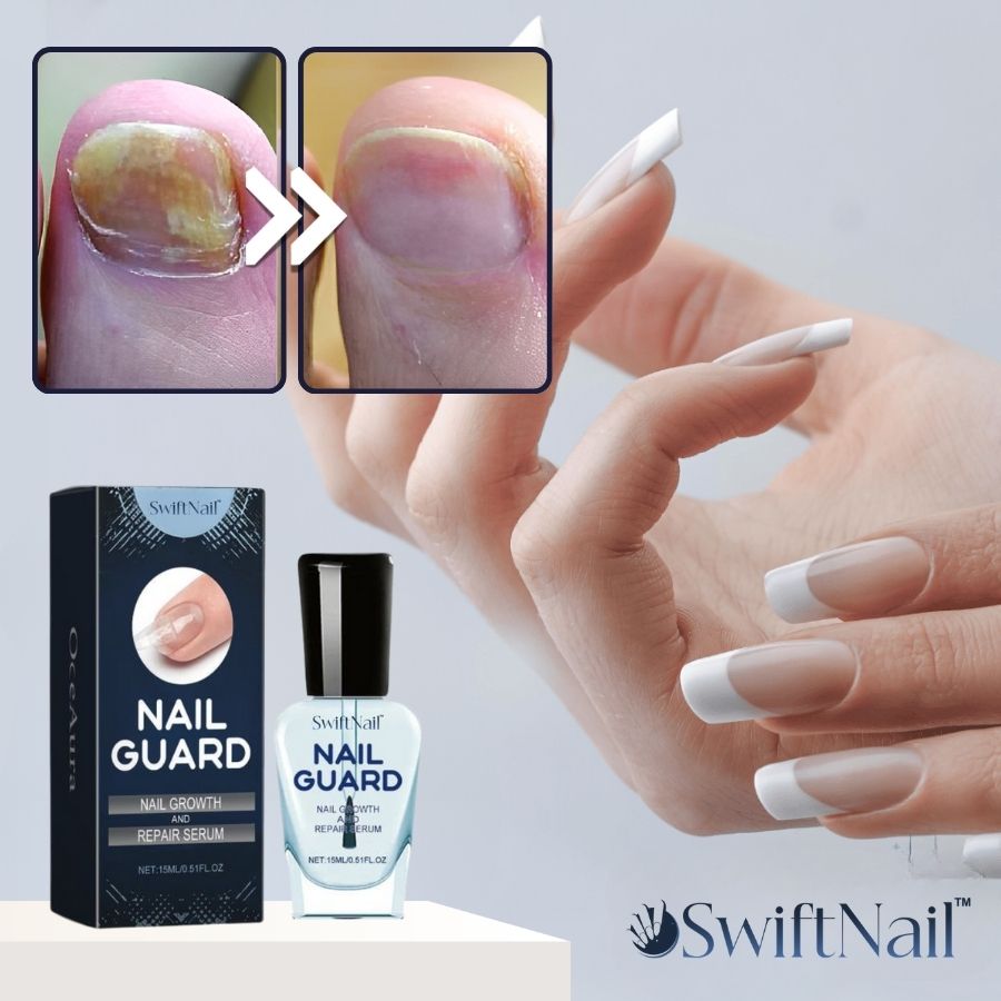 SwiftNail™ | Nail Repair Serum