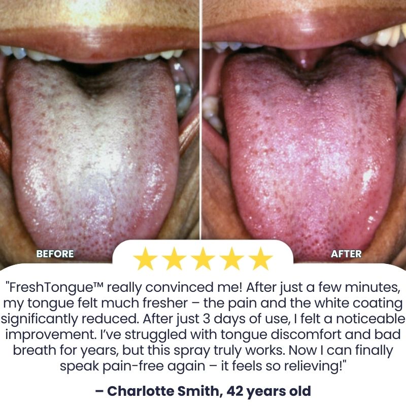 FreshTongue™ | Tongue Repair Spray