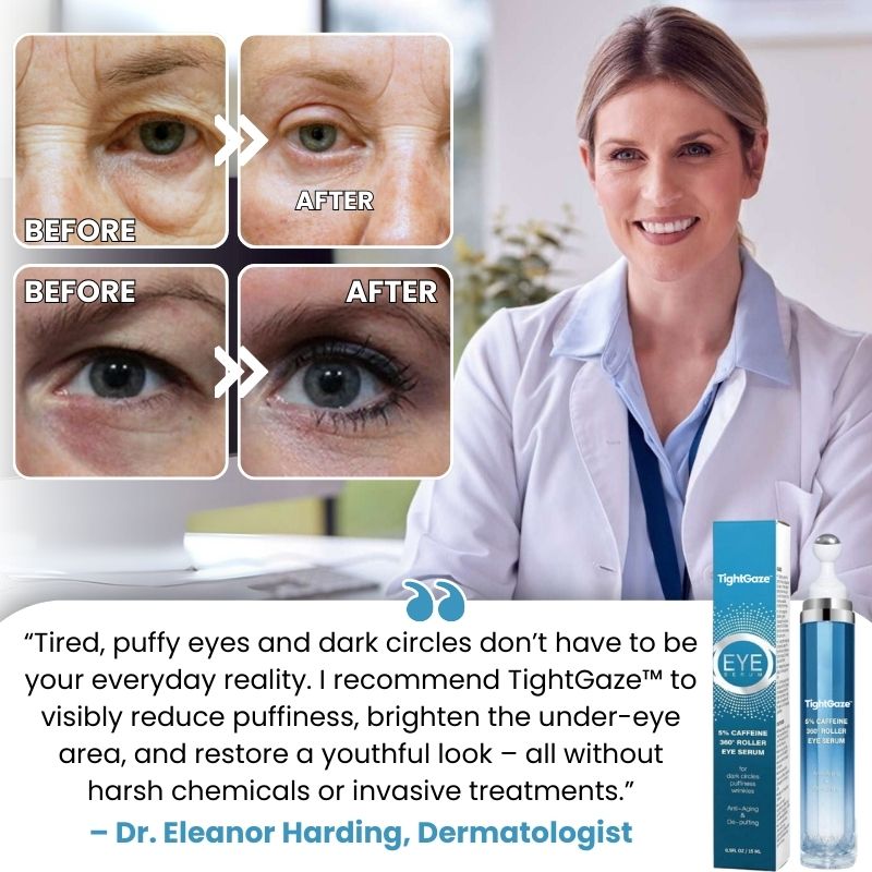 TightGaze™ | Under-Eye Rolling Cream