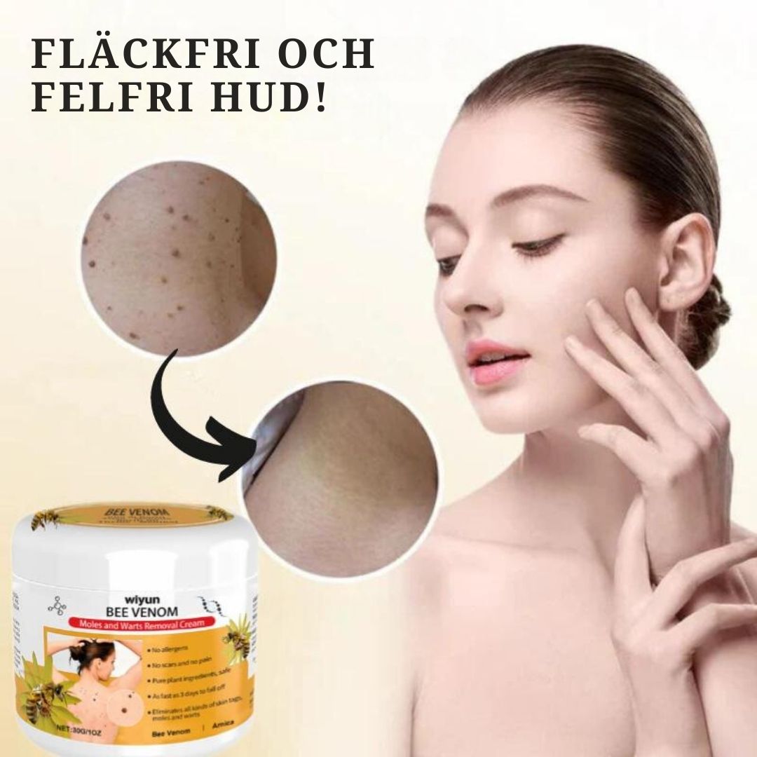 HudKlar™ | Bli av med irriterande hudvårtor på bara 7 Dagar!