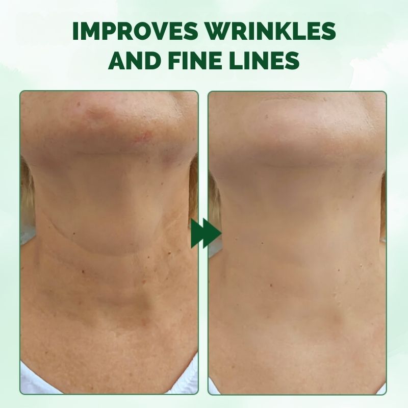 FirmingOil™ | Advanced Skin Firming Oil