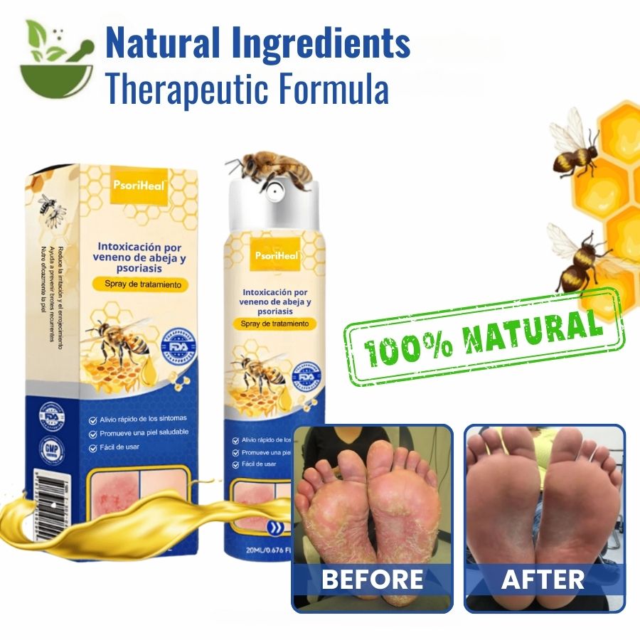 PsoriHeal™ | Psoriasis and Eczema Treatment Spray