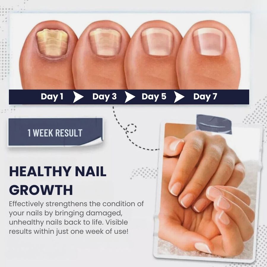 SwiftNail™ | Nail Repair Serum