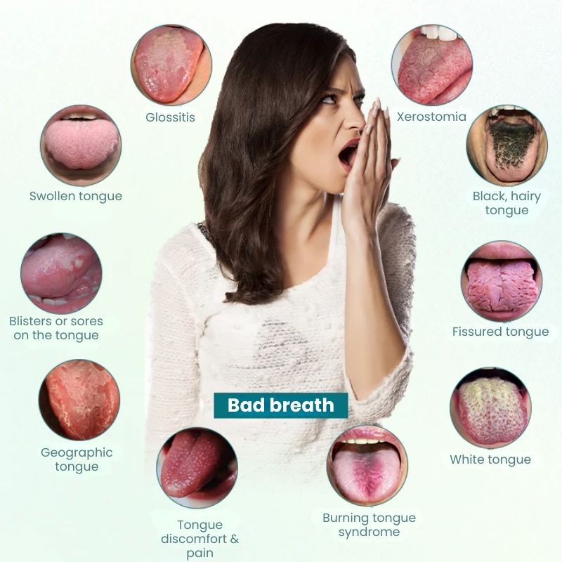 FreshTongue™ | Tongue Repair Spray
