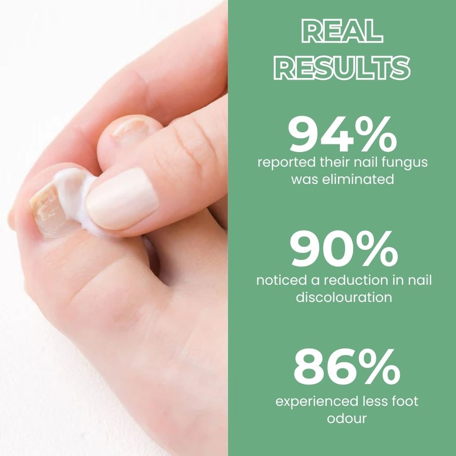 FungBoost™ | Nail Fungus Treatment Gel