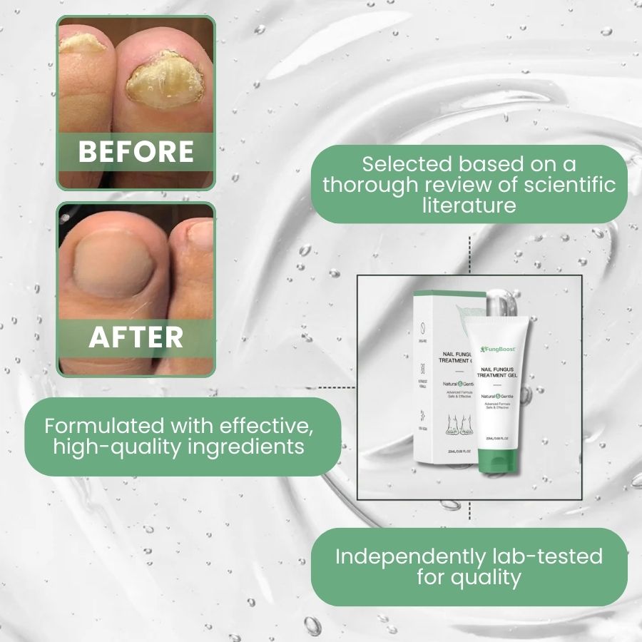 FungBoost™ | Nail Fungus Treatment Gel