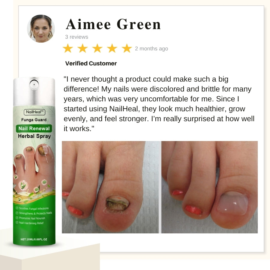 NailHeal™ | Herbal Nail Renewal Spray