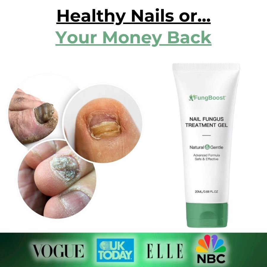 FungBoost™ | Nail Fungus Treatment Gel
