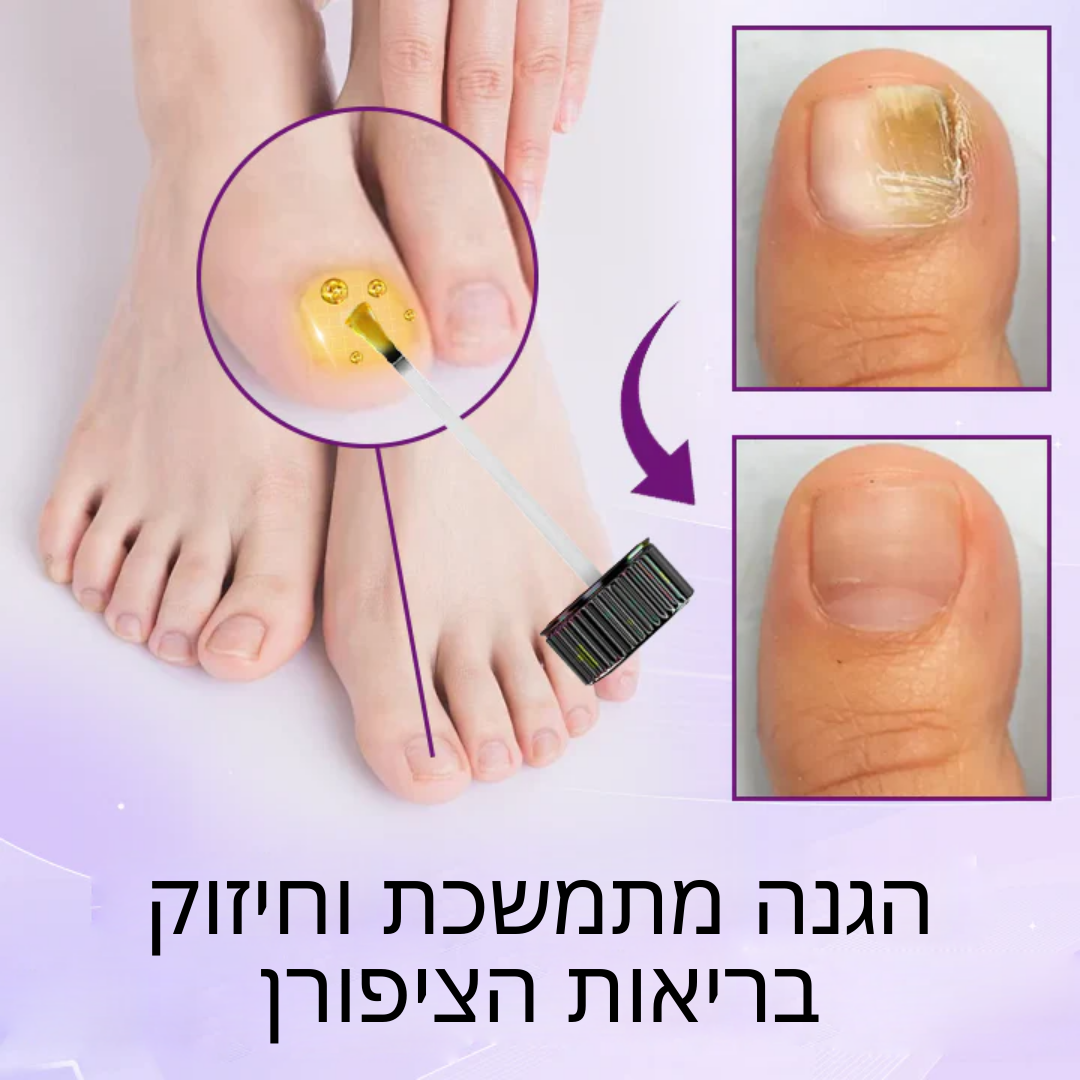 FungiFix | ארס דבורים  סרום לטיפול בציפורניים
