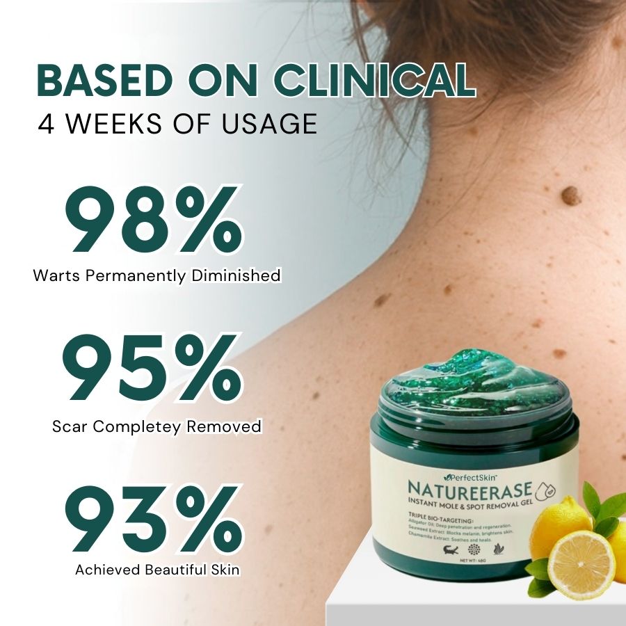 PerfectSkin™ | Instant Mole & Spot Removal Gel