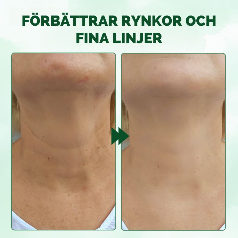 ÅtdragningSolja™ | Avancerad huduppstramande olja