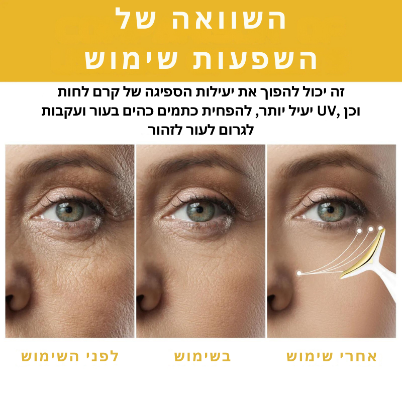 YouthGlow™ | השיבי את המוצקות הצעירה שלך תוך שבוע!