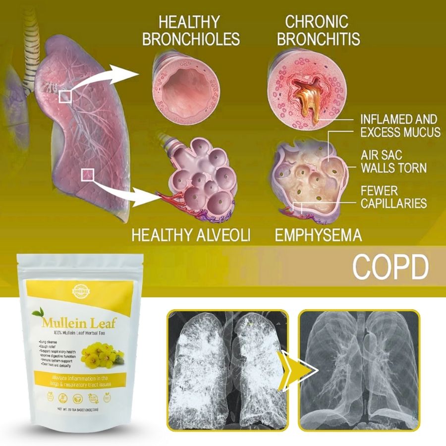 LungClear™ | Better Lungs Tea