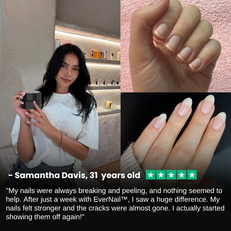 EverNail™ | Nail Repair Protection Gel