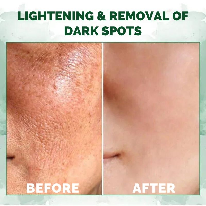 FirmingOil™ | Advanced Skin Firming Oil