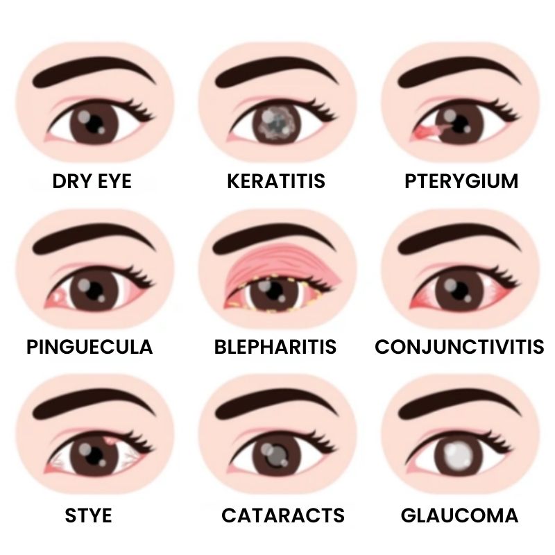 OpticRevive™ | Vision-Enhancing Eye Drops