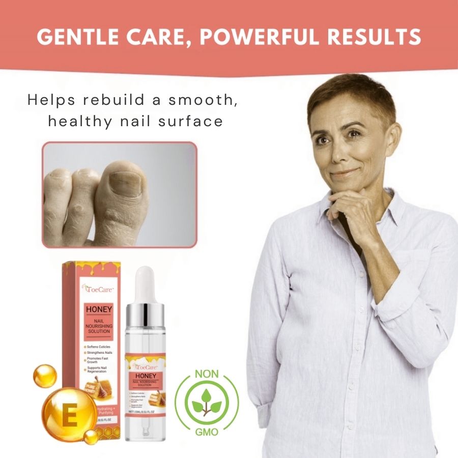 ToeCare™ | Nail Fungal Treatment Drop