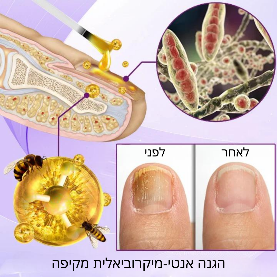FungiFix | ארס דבורים  סרום לטיפול בציפורניים