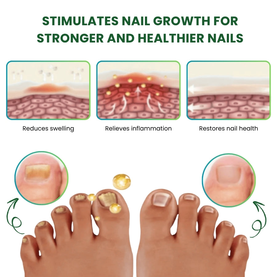 NailHeal™ | Herbal Nail Renewal Spray