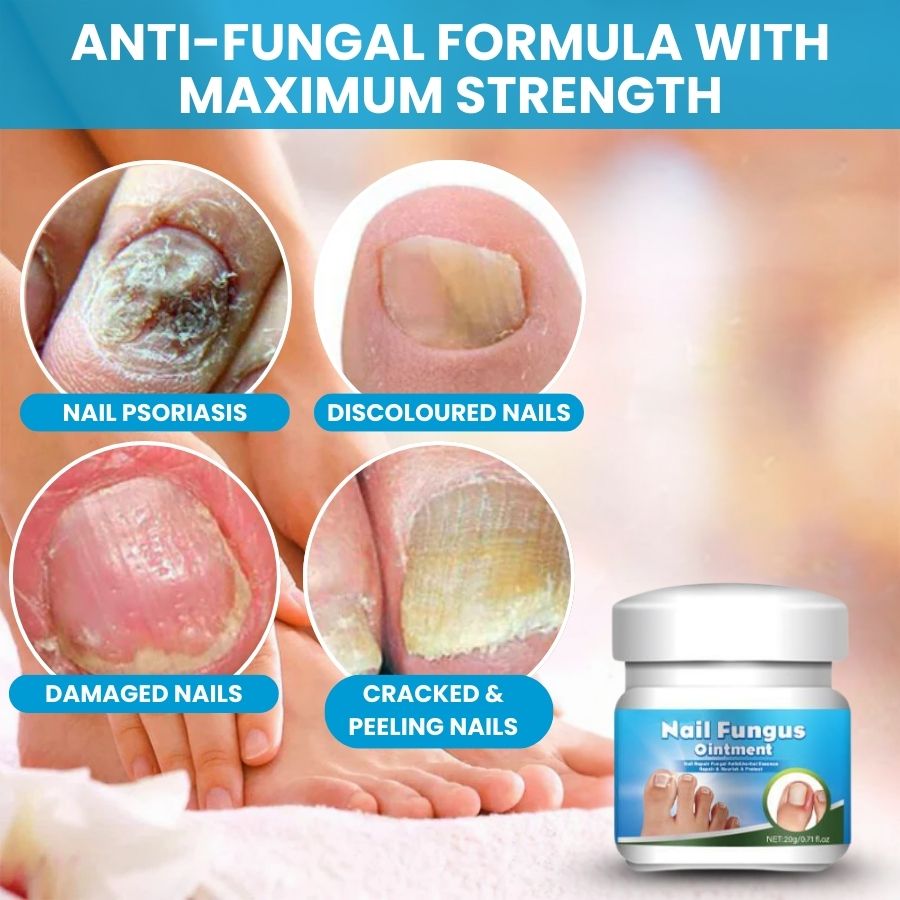 ClearNail™ | Fast Antifungal Ointment