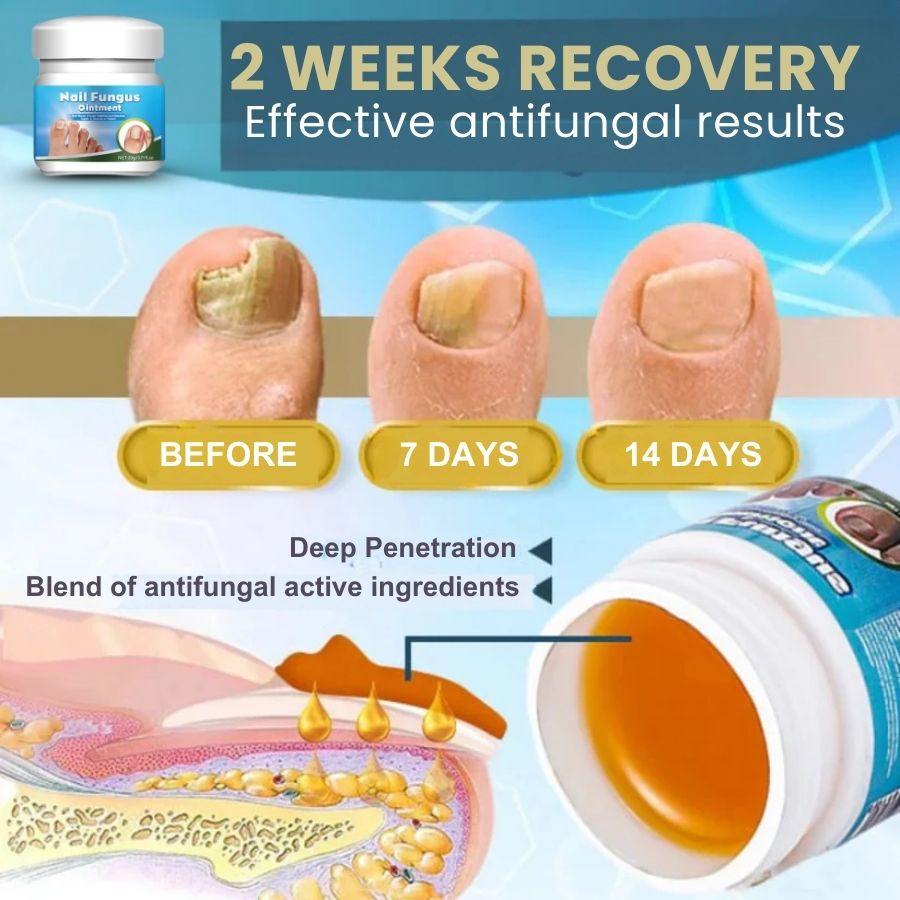 ClearNail™ | Fast Antifungal Ointment