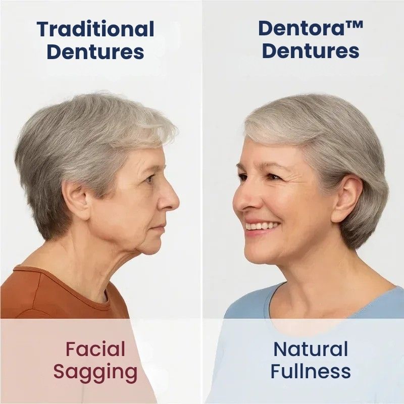 Dentora™ | Instant Denture