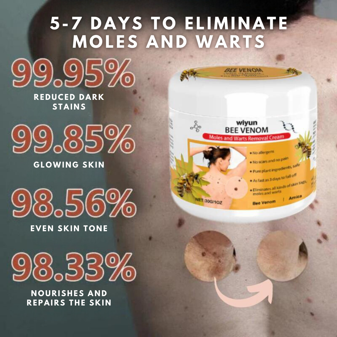 SkinClear™ | Get Rid of Annoying Skin Warts in Just 7 Days!