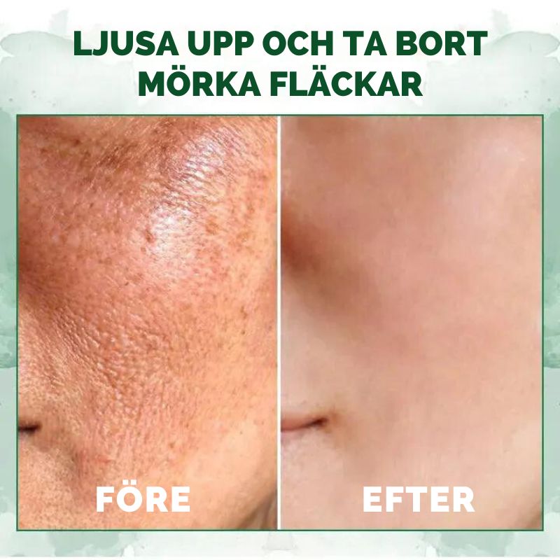 ÅtdragningSolja™ | Avancerad huduppstramande olja