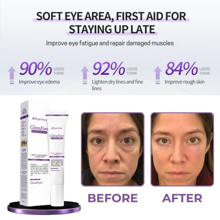 EyeVive™ | Collagen Eye Cream Tube
