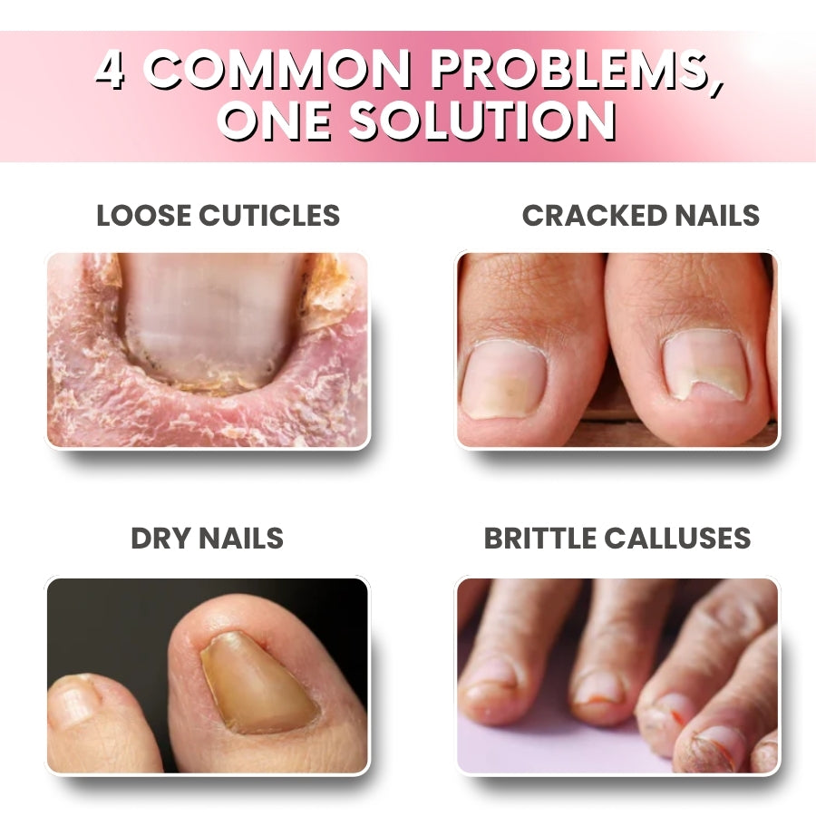 EverNail™ | Nail Repair Protection Gel