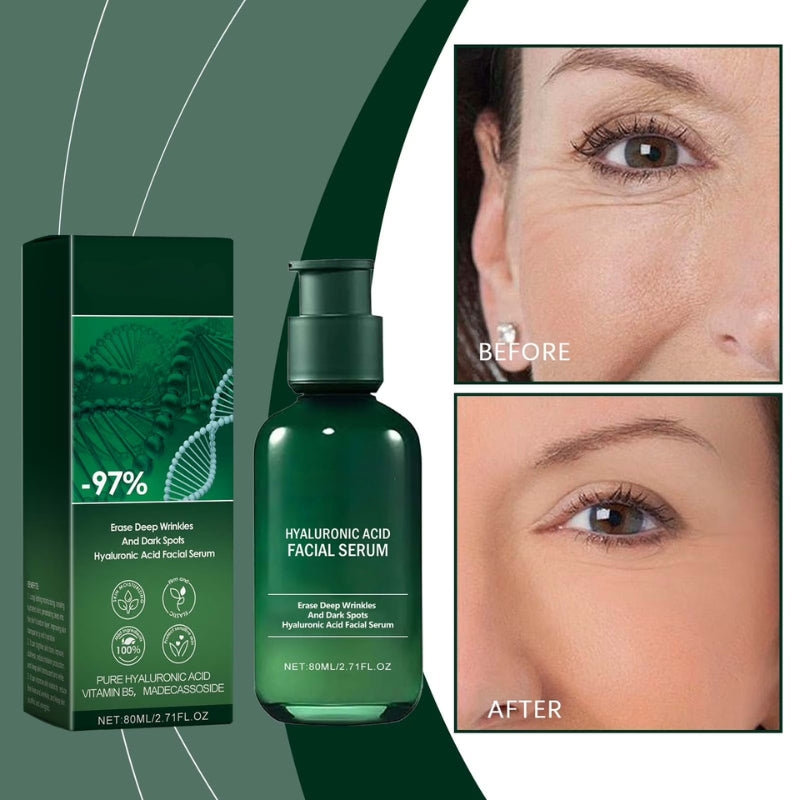 Hyaluronic Face Serum