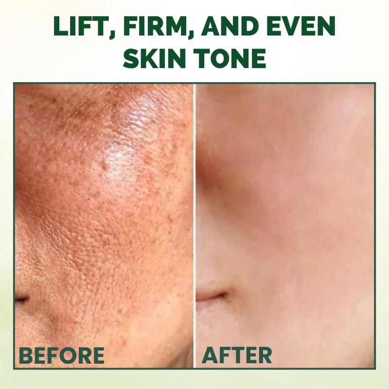 NouriLift™ | Beef Tallow & Manuka Honey Balm for Skin Firming