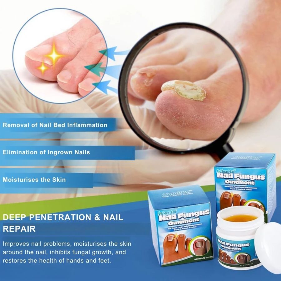 ClearNail™ | Fast Antifungal Ointment