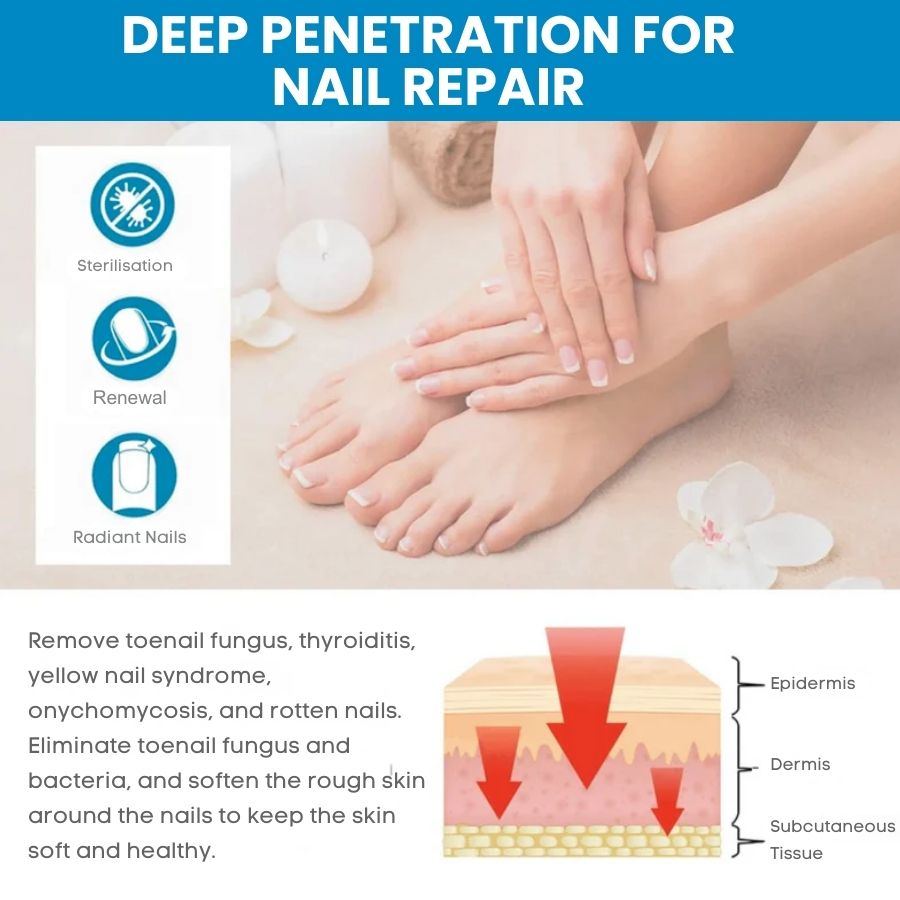 ClearNail™ | Fast Antifungal Ointment