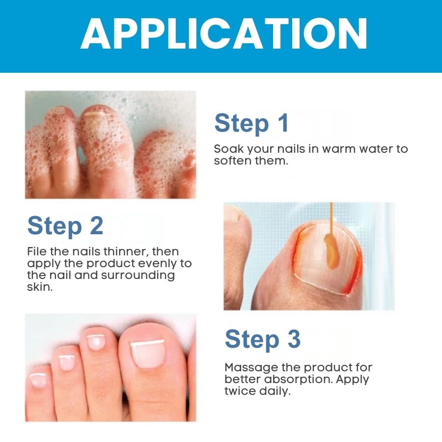 ClearNail™ | Fast Antifungal Ointment