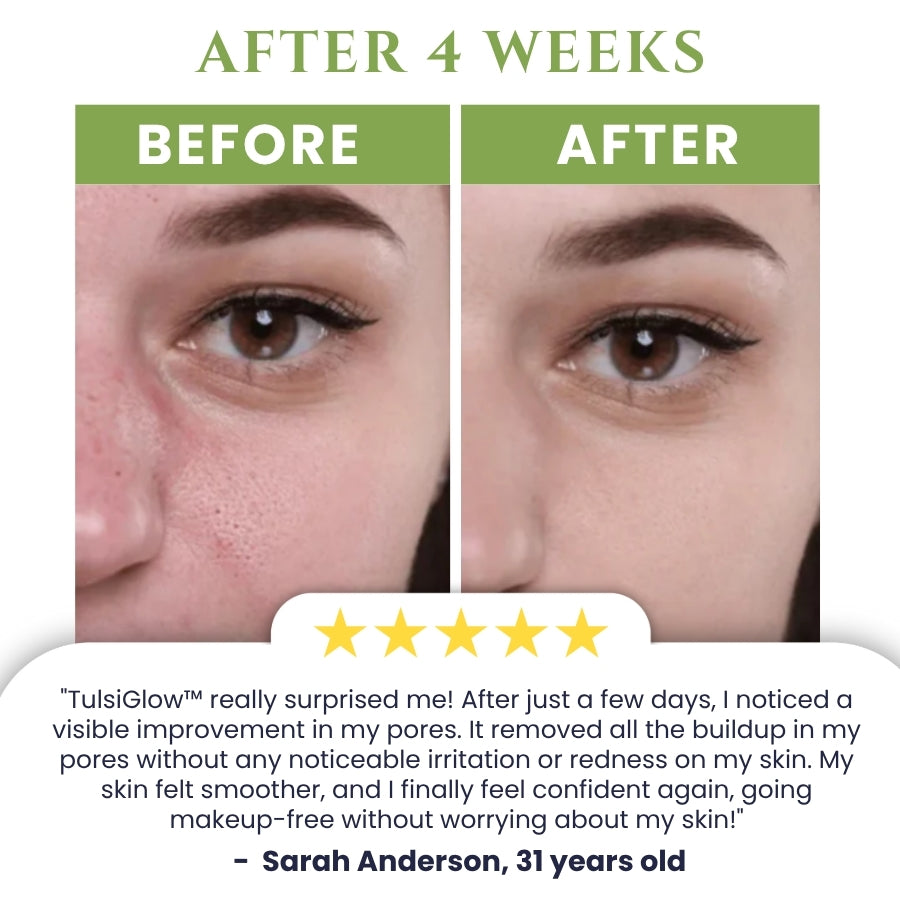 TulsiGlow™ | Holy Basil Bubble Mask