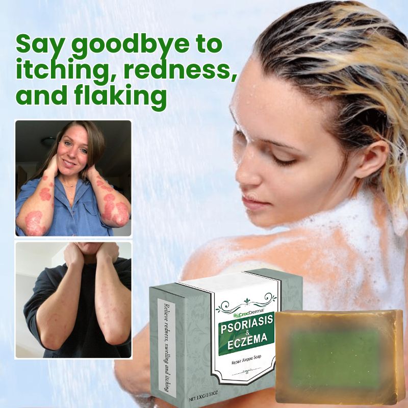 CrocDerma™ | Crocodile Oil Soap for Psoriasis and Eczema
