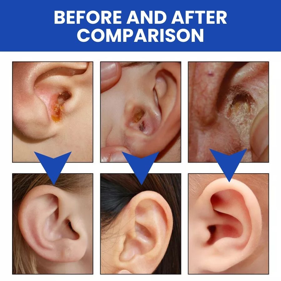 ClearTone™ | Tinnitus Relief Spray