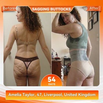 WaistMelt™ | Slimming and Toning Shapewear
