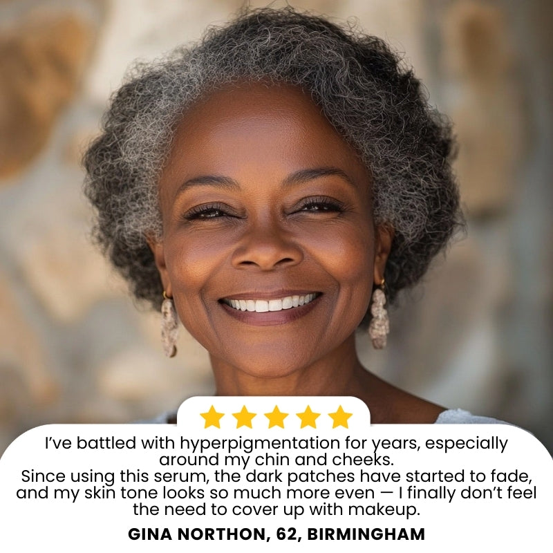Finones™ | Skin Vitamin Serum for Melanin-Rich Skin