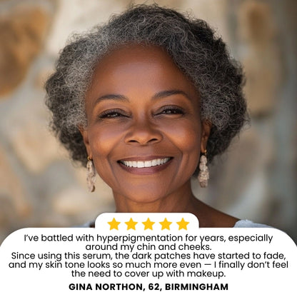 Finones™ | Skin Vitamin Serum for Melanin-Rich Skin