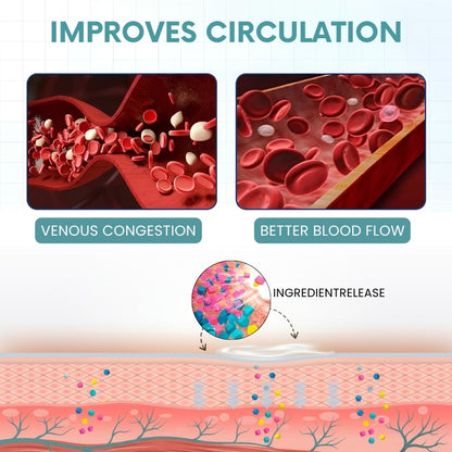 VeinRestore™ | Varicose Vein Cream