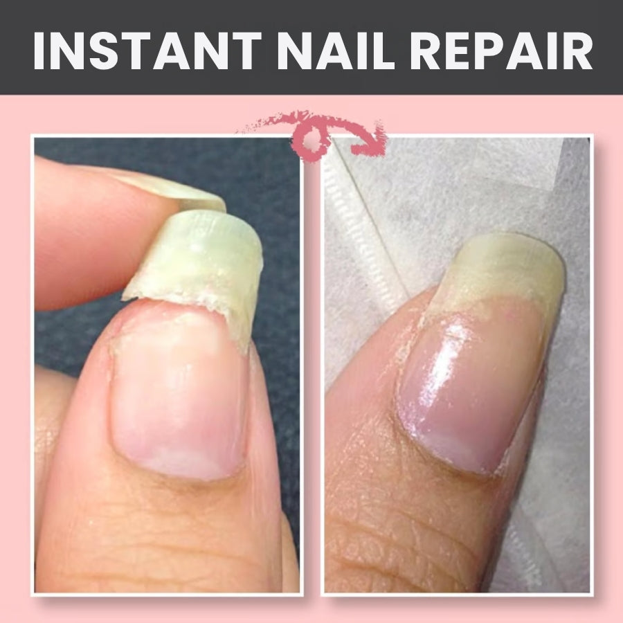 EverNail™ | Nail Repair Protection Gel