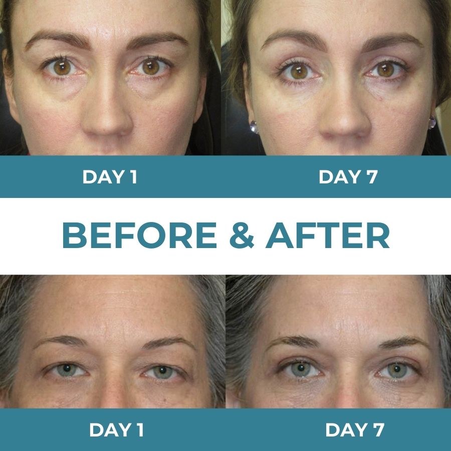 LidEyex™ | Retina Ester Elastic Moisturising Eye Cream