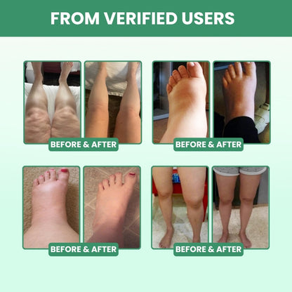 LymphClear™ | Lymphatic Drainage Support Capsules