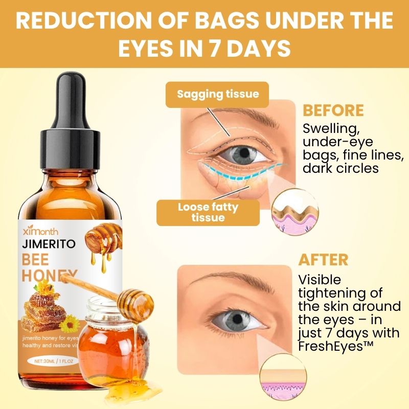 FreshEyes™ | Jimerito Bee Honey