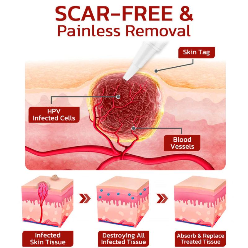 DermaFix™ | Tags & Moles Remover Serum Pen